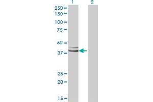 Western Blotting (WB) image for anti-GPN-Loop GTPase 1 (GPN1) (AA 9-118) antibody (ABIN564916)