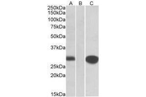 HEK293 lysate (10ug protein in RIPA buffer) overexpressing Human MID1IP1 with C-terminal MYC tag probed with AP22415PU-N (1 µg/ml) in Lane A and probed with anti-MYC Tag (1/1000) in lane C. (m1ip1 抗体  (Internal Region))
