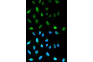 Immunofluorescence analysis of HeLa cells using CBX5 antibody. (CBX5 抗体  (AA 1-191))