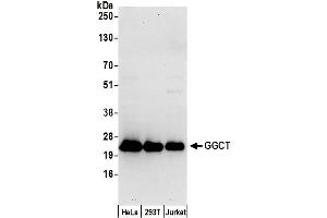 anti-gamma-Glutamylcyclotransferase (GGCT) (AA 138-188) antibody