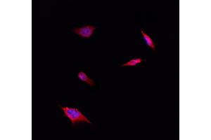 ABIN6261450 and ABIN6266845 staining Hela by IF/ICC.