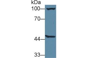 Western Blot; Sample: Mouse Liver lysate; Primary Ab: 1µg/ml Rabbit Anti-Mouse AGXT2 Antibody Second Ab: 0. (AGXT2 抗体  (AA 226-513))