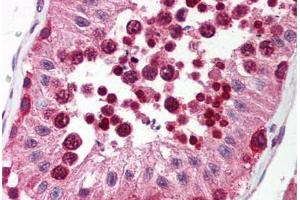 Human Testis (formalin-fixed, paraffin-embedded) stained with UNG antibody ABIN214542 at 5 ug/ml followed by biotinylated goat anti-rabbit IgG secondary antibody ABIN481713, alkaline phosphatase-streptavidin and chromogen.