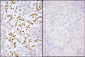 Immunohistochemistry (IHC) image for anti-X-Ray Repair Complementing Defective Repair in Chinese Hamster Cells 1 (XRCC1) (pSer485), (pThr488) antibody (ABIN7448871)