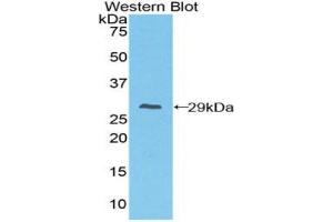 Western blot analysis of recombinant Mouse FcgRI.