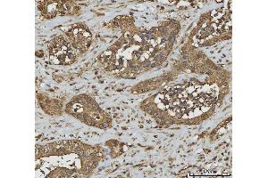 IHC analysis of Annexin A10/ANXA10 using anti-Annexin A10/ANXA10 antibody (ABIN7601853). (Annexin a10 抗体  (AA 49-324))