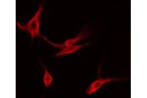 ABIN6274565 staining Hela cells by IF/ICC. (14-3-3 gamma 抗体  (Internal Region))