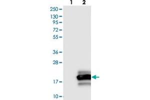Western blot analysis of Lane 1: Negative control (vector only transfected HEK293T lysate), Lane 2: Over-expression Lysate (Co-expressed with a C-terminal myc-DDK tag (~3. (Otoraplin 抗体)