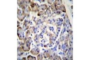 Immunohistochemistry analysis in formalin fixed and paraffin embedded human pancreas tissue reacted with Midkine Antibody (C-term) followed which was peroxidase conjugated to the secondary antibody and followed by DAB staining.
