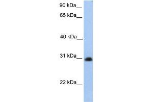 WB Suggested Anti-CHST14 Antibody Titration:  0. (CHST14 抗体  (Middle Region))
