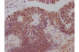 Immunohistochemistry (IHC) image for anti-SIN3 homolog A, transcription regulator (SIN3A) antibody (ABIN7127630)