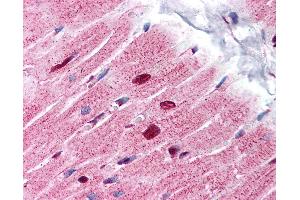 Anti-ANP32A antibody IHC of human heart. (PHAP1 抗体  (C-Term))