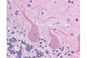 Anti-ACCN4 antibody IHC of human brain, cerebellum. (ACCN4 抗体  (AA 121-170))