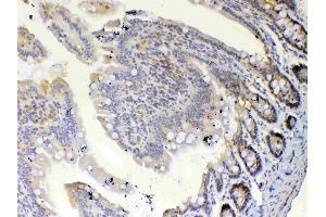 Immunohistochemistry (IHC) image for anti-Ets Variant 6 (ETV6) (AA 327-448) antibody (ABIN5693220)