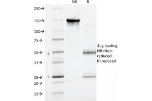 SDS-PAGE Analysis Purified Catenin, gamma Mouse Monoclonal Antibody (CTNG/1664). (JUP 抗体)