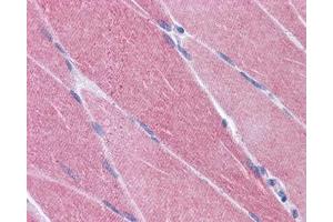 IHC testing of FFPE human skeletal muscle tissue with CREB3L1 antibody at 3. (CREB3L1 抗体)