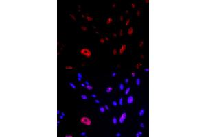 Immunofluorescence analysis of U2OS cells using HUS1 antibody (ABIN5973136). (HUS1 抗体)