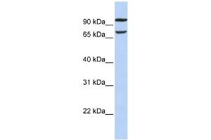 FAM38B antibody used at 1 ug/ml to detect target protein. (PIEZO2 抗体  (Middle Region))