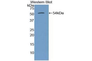 Detection of Recombinant TUBb3, Human using Polyclonal Antibody to Tubulin Beta 3 (TUBb3) (TUBB3 抗体  (AA 222-438))