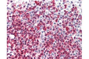 Anti-DKC1 antibody IHC of human spleen. (DKC1 抗体  (AA 446-460))
