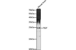 Western blot analysis of extracts of mouse brain, using PIGP antibody (ABIN7269289) at 1:1000 dilution.