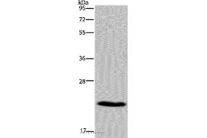 Western blot analysis of Mouse heart tissue, using CMTM5 Polyclonal Antibody at dilution of 1:400 (CMTM5 抗体)
