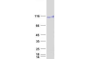 Validation with Western Blot (EPH Receptor B4 Protein (EPHB4) (Myc-DYKDDDDK Tag))