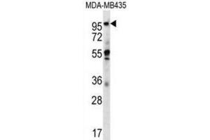 Western Blotting (WB) image for anti-Melanoma Inhibitory Activity Protein 2 (MIA2) antibody (ABIN2996927) (MIA2 抗体)