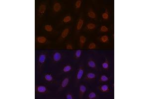 Immunofluorescence analysis of U-2 OS cells using RanG Rabbit mAb (ABIN7269846) at dilution of 1:100 (40x lens). (RANGAP1 抗体)