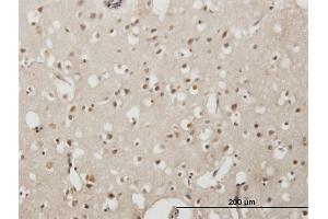 Immunoperoxidase of monoclonal antibody to EMX2 on formalin-fixed paraffin-embedded human cerebral cortex. (EMX2 抗体  (AA 103-200))