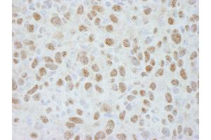 Immunohistochemistry (IHC) image for anti-Damage Specific DNA Binding Protein 1 (DDB1) (C-Term) antibody (ABIN7448511) (DDB1 抗体  (C-Term))