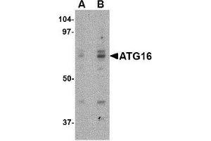 Western blot analysis of ATG16 in HeLa cell lysate with ATG16 antibody at (A) 0.
