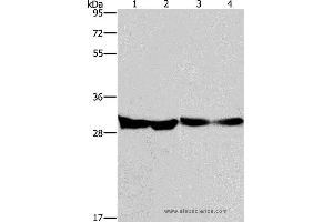 Western blot analysis of Human endometrial carcinoma and colon cancer tissue, mouse heart tissue and PC3 cell, using DECR1 Polyclonal Antibody at dilution of 1:300 (DECR1 抗体)