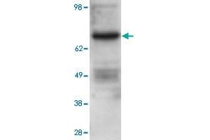 Western blot using PRKCB polyclonal antibody  shows detection of PRKCB in ~25 ug of U251 whole cell lysate (glioma derived). (PKC beta 抗体  (Internal Region))