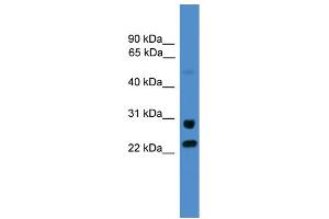 WB Suggested Anti-KIAA0152  Antibody Titration: 0. (Malectin 抗体  (C-Term))