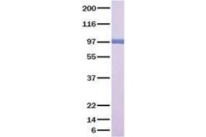 Western Blotting (WB) image for Hepatocyte Growth Factor (Hepapoietin A, Scatter Factor) (HGF) (Transcript Variant 1) (Active) protein (ABIN5505653)