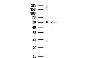 Western blot analysis of lysates from HepG2 cells(starvation,24h treatment), using FLI1 Antibody at 1/1000 dilution.