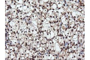 Image no. 1 for anti-SAM Domain and HD Domain 1 (SAMHD1) antibody (ABIN1500798) (SAMHD1 抗体)
