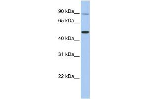 Western Blotting (WB) image for anti-Transient Receptor Potential Cation Channel, Subfamily V, Member 5 (TRPV5) (N-Term) antibody (ABIN2783755)