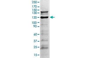 The tissue lysate derived from GH stimulated mouse liver was immunoblotted by JAK2 (phospho Y1007/Y1008) polyclonal antibody  at 1 : 500. (JAK2 抗体  (pTyr1007, pTyr1008))