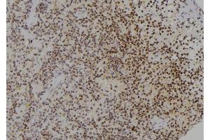 ABIN6277250 at 1/100 staining Rat spleen tissue by IHC-P. (PCBP2 抗体  (Internal Region))