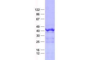 Validation with Western Blot (PRR11 Protein (His tag))