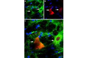 Expression of P2RX4 in rat brain Immunohistochemical staining of rat brain red nucleus using Anti-P2X4 Receptor Antibody (ABIN7581930).
