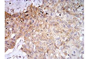 Immunohistochemistry (IHC) image for anti-Phospholipase D2 (PLD2) (AA 834-933) antibody (ABIN5881791) (Phospholipase D2 抗体  (AA 834-933))