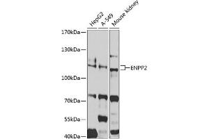 Western blot analysis of extracts of various cell lines, using ENPP2 antibody (ABIN3023333, ABIN3023334, ABIN3023335 and ABIN6219607) at 1:1000 dilution.