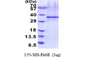SDS-PAGE (SDS) image for Four and A Half LIM Domains 2 (FHL2) (AA 1-279) protein (His tag) (ABIN5853936) (FHL2 Protein (AA 1-279) (His tag))