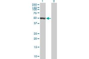 Western Blot analysis of HARS expression in transfected 293T cell line by HARS MaxPab polyclonal antibody. (HARS1/Jo-1 抗体  (AA 1-509))