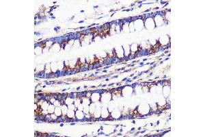 Immunohistochemistry of paraffin-embedded Human colon using MRPL54 Rabbit pAb (ABIN7268578) at dilution of 1:100 (40x lens). (MRPL54 抗体  (AA 1-138))