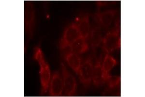 Image no. 3 for anti-Protein-tyrosine Phosphatase 1C (PTPN6) (Tyr536) antibody (ABIN197592) (SHP1 抗体  (Tyr536))