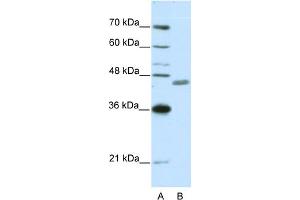 WB Suggested Anti-ZNF396 Antibody Titration:  0. (ZNF396 抗体  (N-Term))